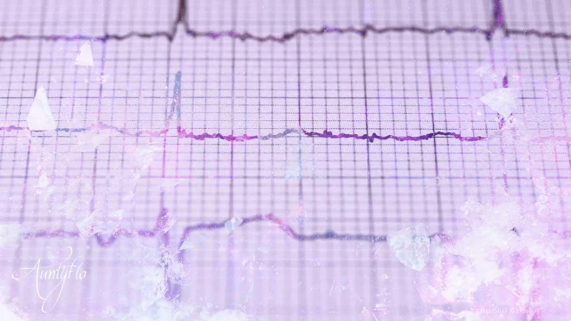 Causes Possibles Des Rêves De Crise Cardiaque