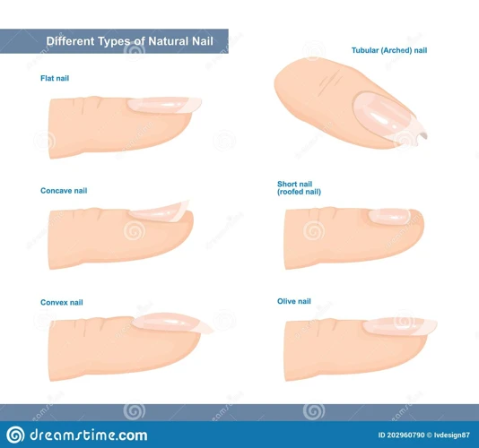 Les Différents Types De Rêves D'Ongles